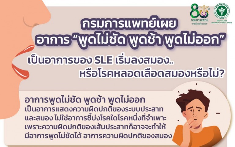 กรมการแพทย์SLE